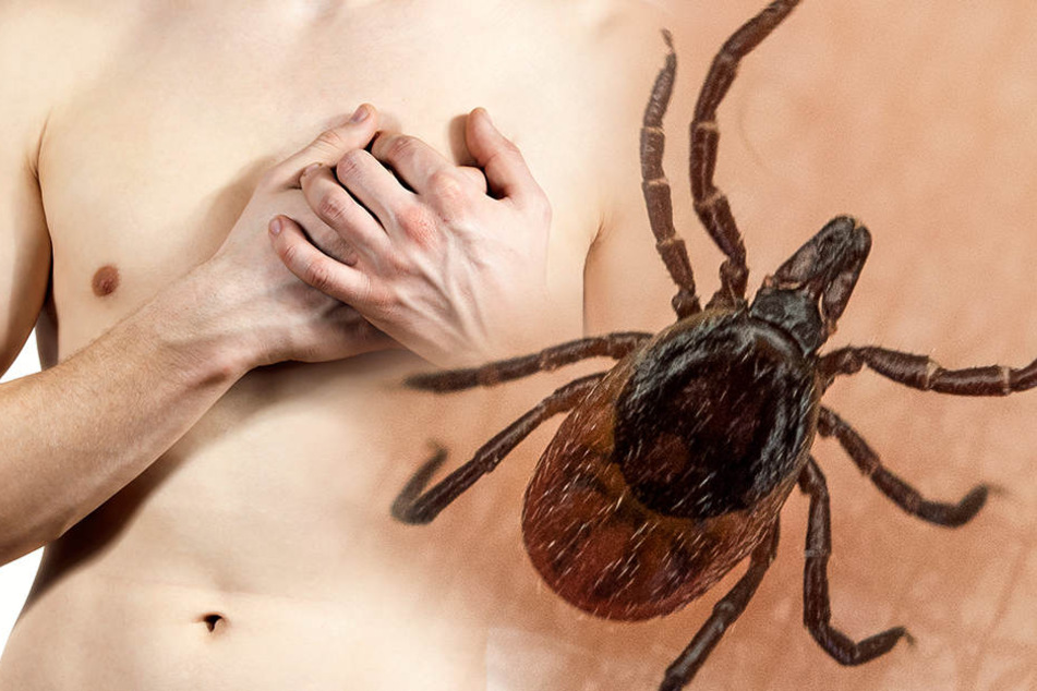 Zecken sind pfiffig: Die nutzen ihre Spucke, um den Menschen, was sie anzapfen wollen, zu betäuben.
