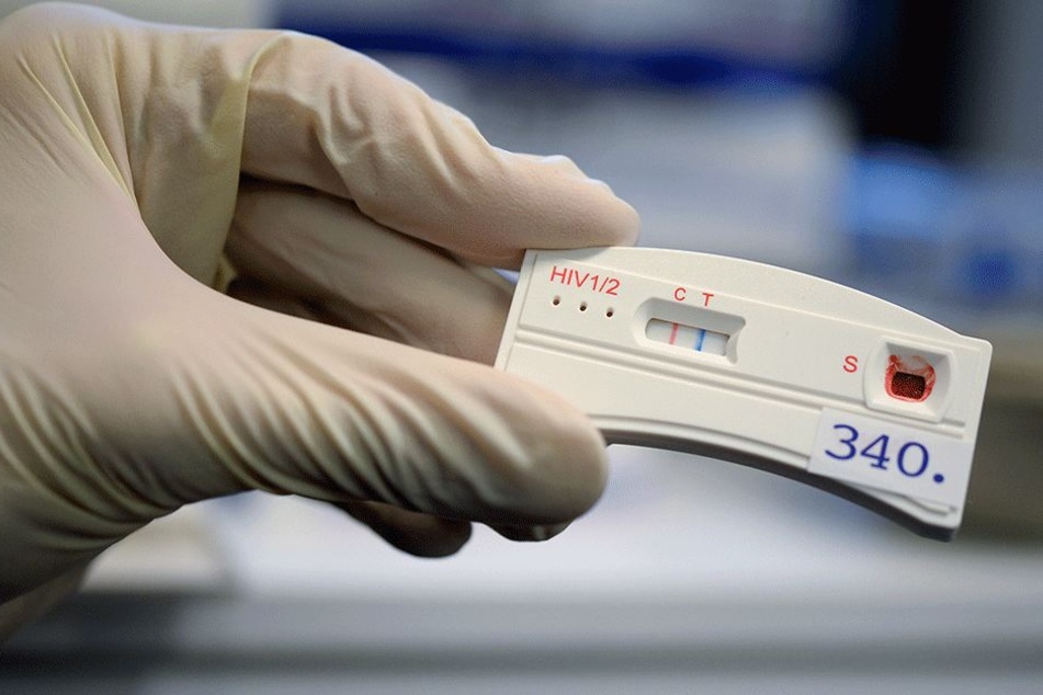 Der Teststreifen an einem HIV-Schnelltest verfärbt sich... (Symbolbild)