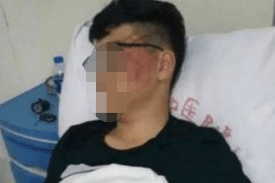 Der Schüler landete im Krankenhaus.