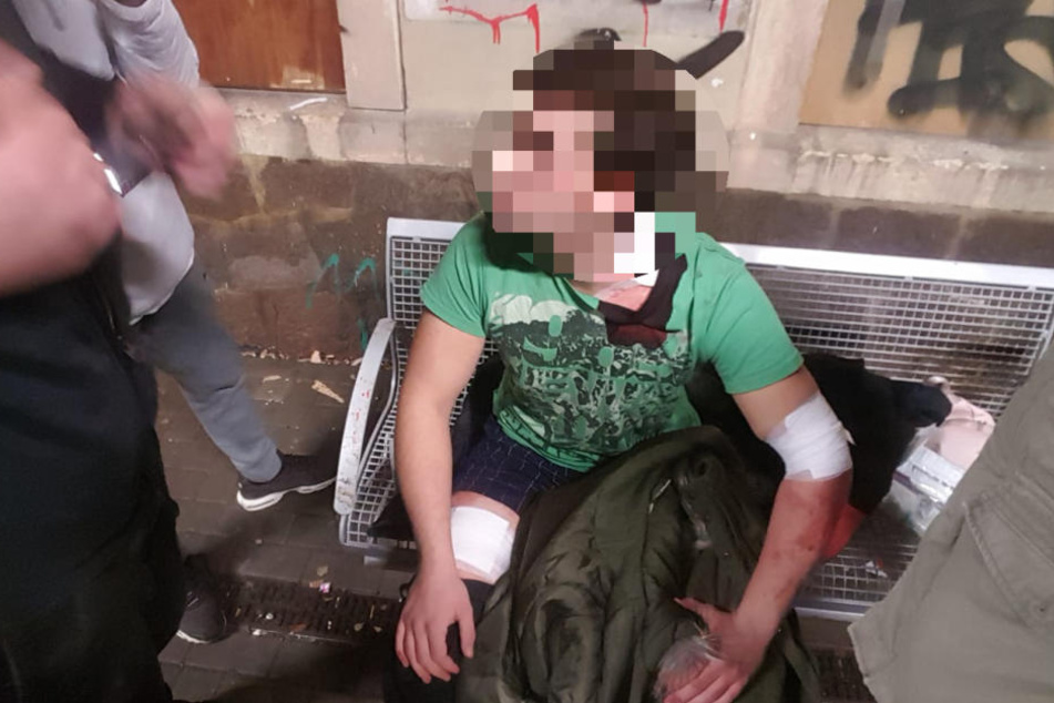 Der 17-Jährige erlitt drei Messerstiche in Oberschenkel und Hals.