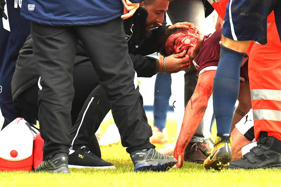 Bei dem Regionalliga-Spiel des SC Wiedenbrück gegen die SG Wattenscheid kam es zu einem Horror-Zusammenprall.