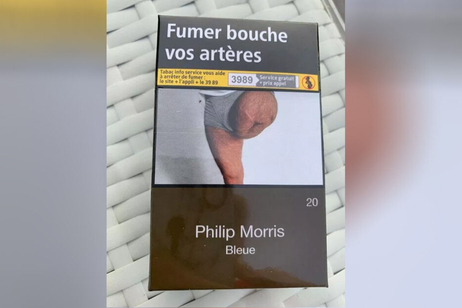 Dieses Bild zeigt das amputierte Bein des 60-Jährigen.