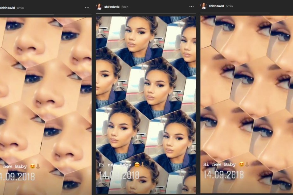 Stolz präsentiert Influencerin Shirin David (23) ihr neues Stupsnäschen.