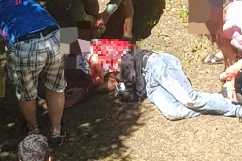Der 21-Jährige wurde durch die Stiche lebensgefährlich verletzt.