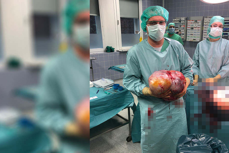 Ganze 10,2 Kilo Tumor entfernten die Ärzte.
