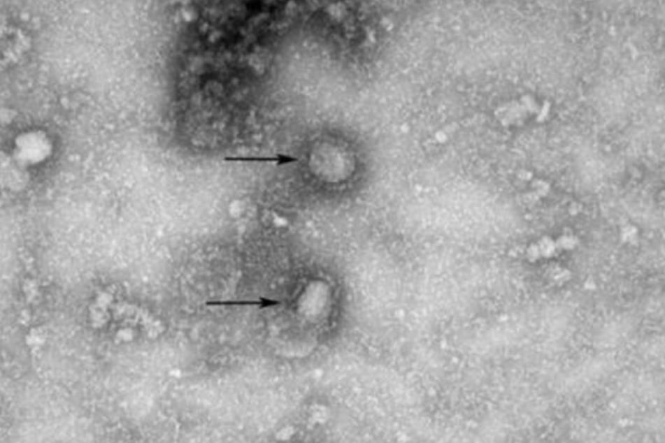 Das Foto zeigt einen neuen Stamm des Coronavirus, der in der chinesischen Stadt Wuhan zahlreiche Menschen an Lungenentzündung erkranken ließ.