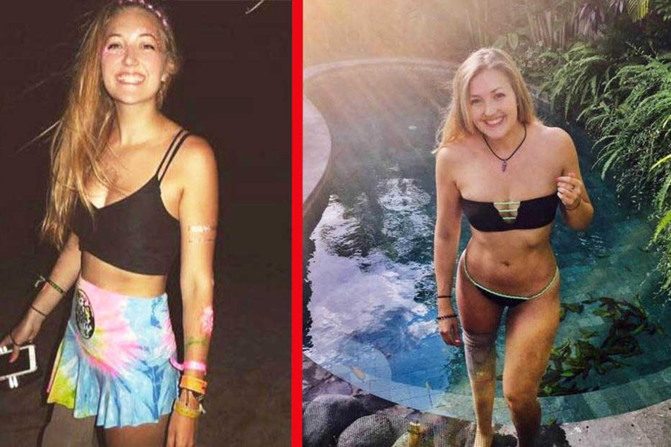 Rosie Bancroft (23) kam ohne rechten Unterschenkel zur Welt.