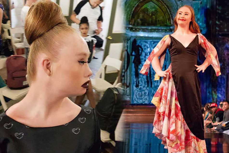 Madeline hat sich als Model mit Down-Syndrom einen Namen gemacht.
