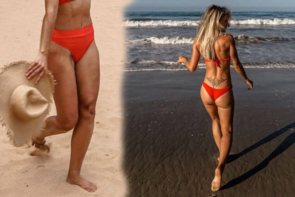 Hier stellt Adrienne Koleszar (34) ihre "Makel" offen zur Schau.