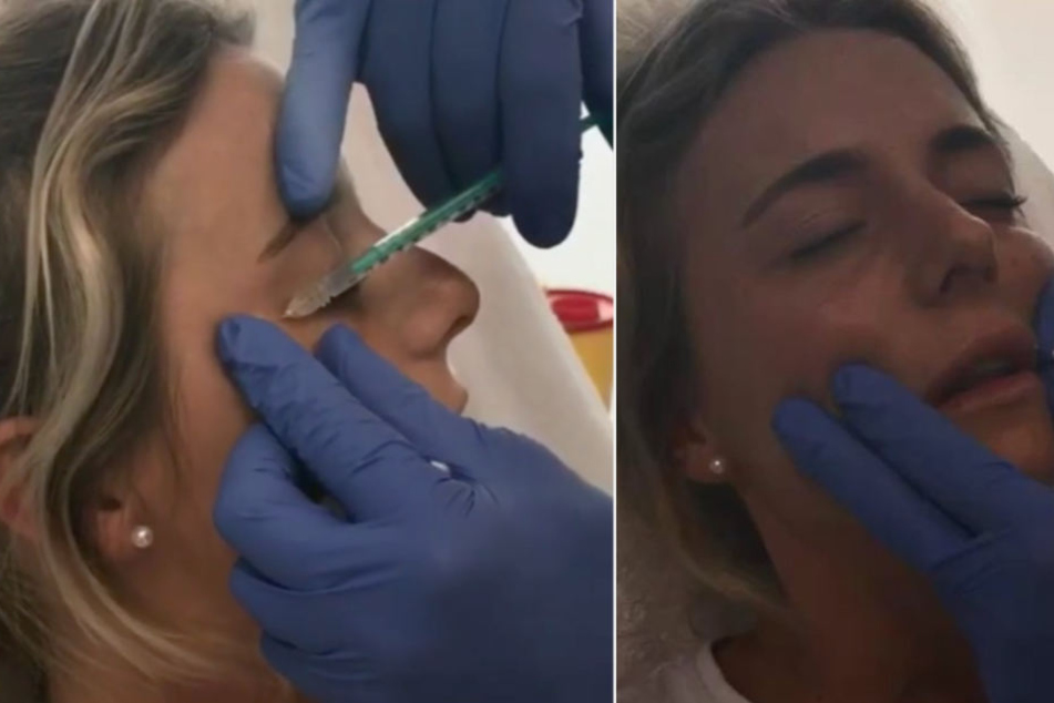 Janina Celine ließ sich Lippen und Wangenknochen aufspritzen.
