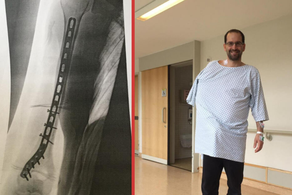 Alexander "Ali" Berger brach sich bei dem Unfall den Arm, inzwischen geht es dem Altenploser dem Umständen entsprechend gut.