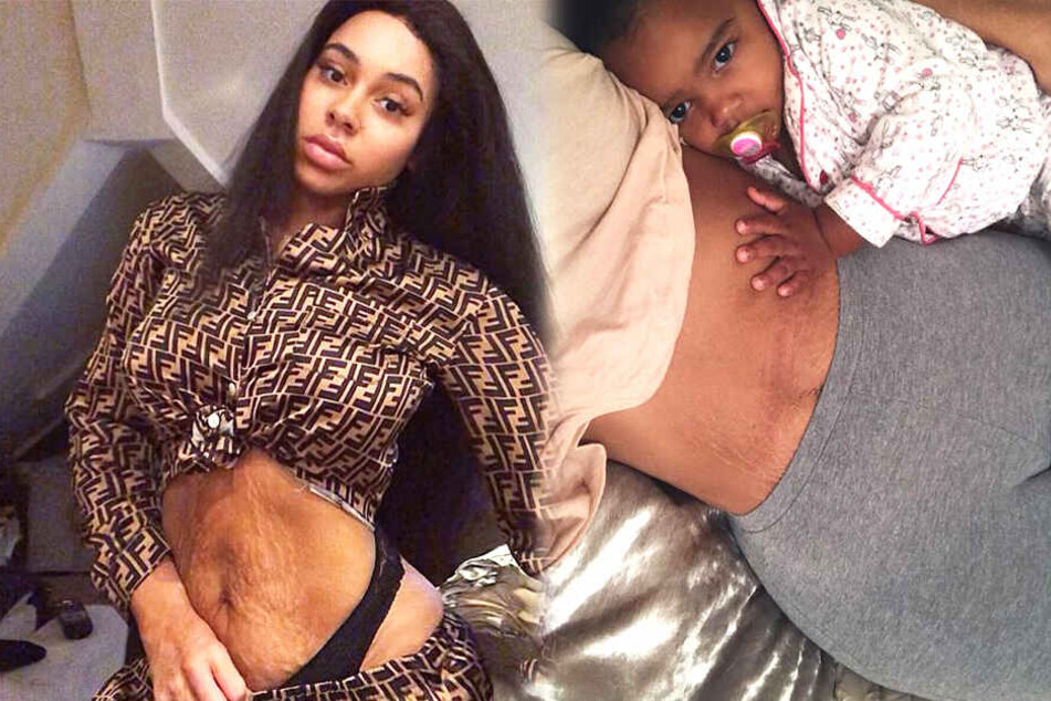 Chelsea Rochdale (23) mag ihren Körper genau so wie er ist und möchte allein stehenden Müttern ein Vorbild sein.