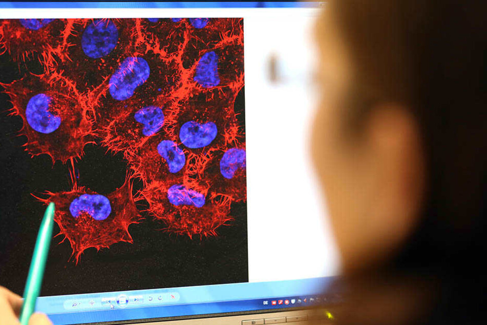 Moderne Hautkrebsdiagnostik findet heutzutage oft am PC statt. Im US-Bundesstaat Michigan geschah dies dank eines Social-Media-Schnappschusses.