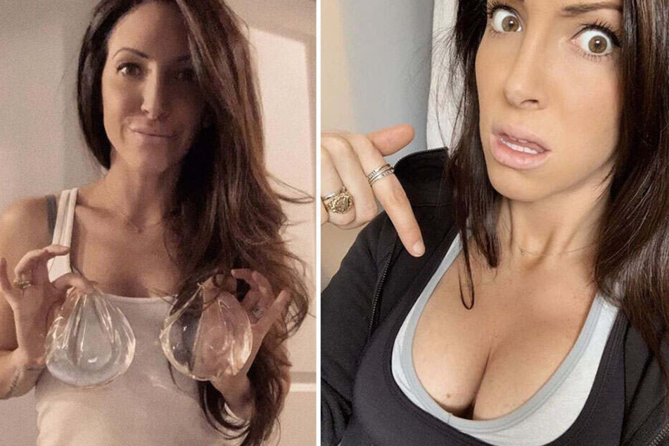 Bianca Weintraub hält ihre ehemaligen Implantate in den Händen.