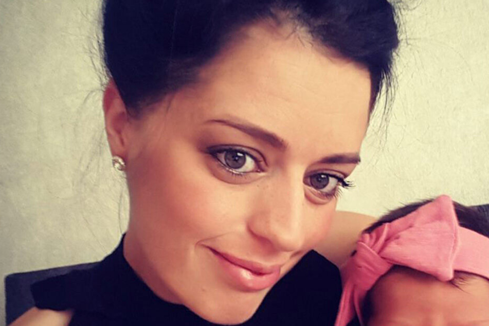 Tanya Hughes (31) versteckte ihre vielen kahlen Stellen so erfolgreich, dass ihr Freund zwei Jahre nichts merkte.