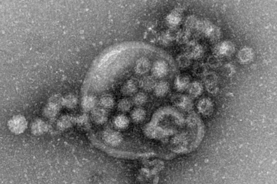 Klein, aber oho: Das Norovirus unterm Mikroskop.