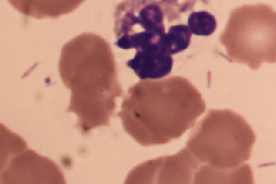 Capnocytophaga canimorsus (lat. canimorsus "Hundebiss") kommt im Maul von Hunden und Katzen vor.