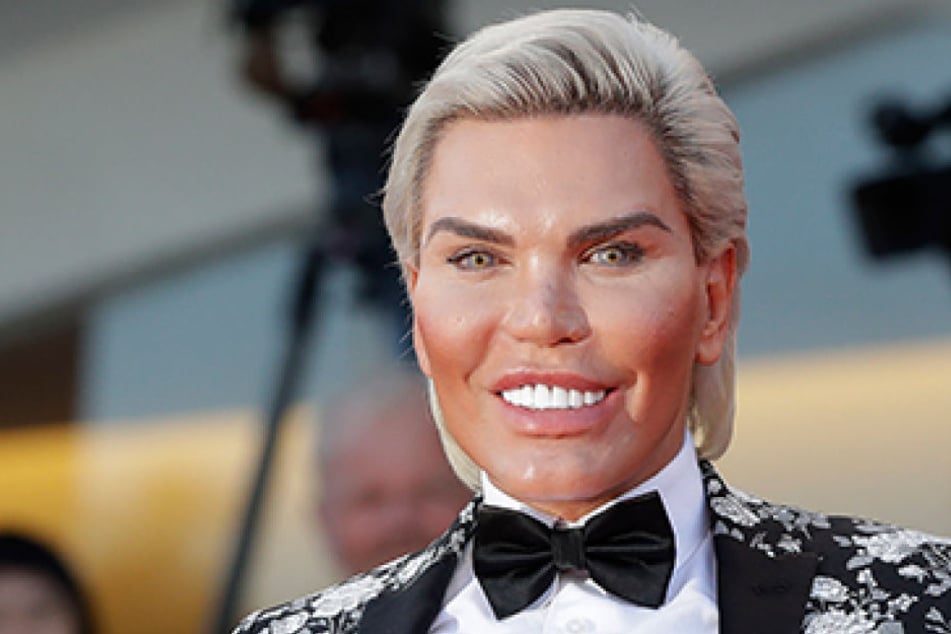 Rodrigo Alves hat sich schon sehr oft unters Messer gelegt. Sein bestes Stück will er sich allerdings nicht entfernen lassen.