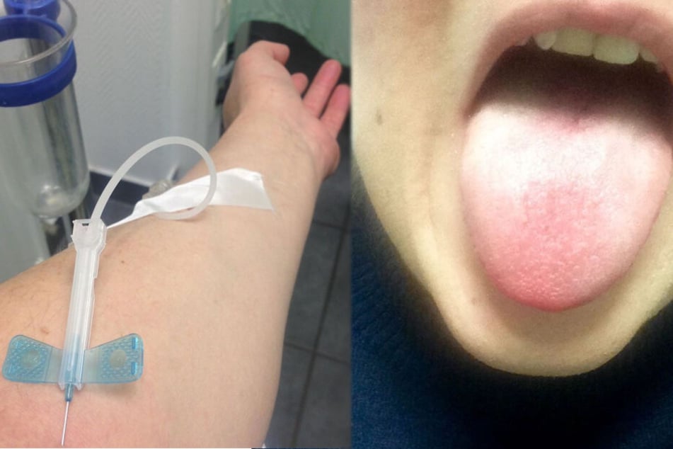 Im Arm von Helena Fürst steckt eine Infusionsnadel, ihre Zunge ist weiß belegt.