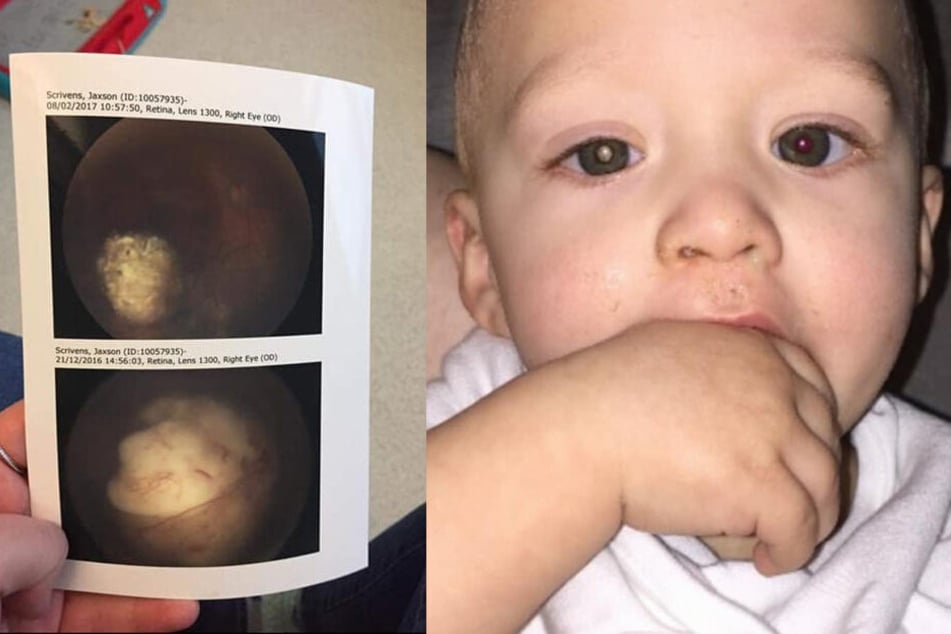 Das rechte Foto rettete dem Jungen am Ende das Leben. Deutlich sieht man, dass sich seine beiden Augen voneinander unterscheiden.