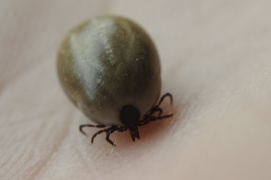 Eine mit Blut vollgesaugte Zecke auf menschlicher Haut: Auch 2018 wird es wieder viele Borreliose-Fälle durch Zeckenbisse geben.