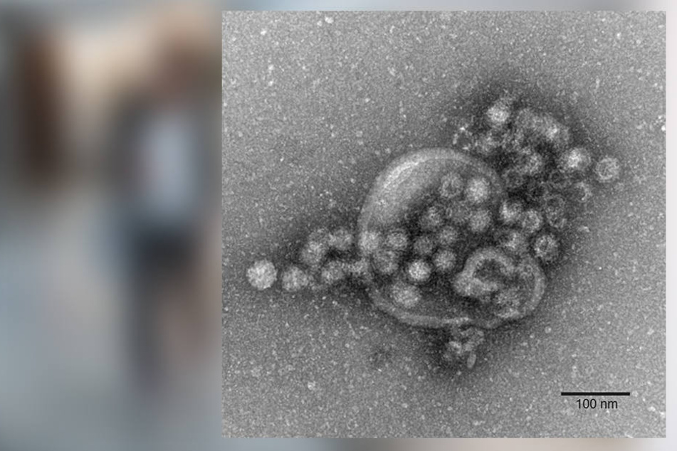 In diesem Jahr haben sich schon mehr Menschen mit dem Norovirus angesteckt.