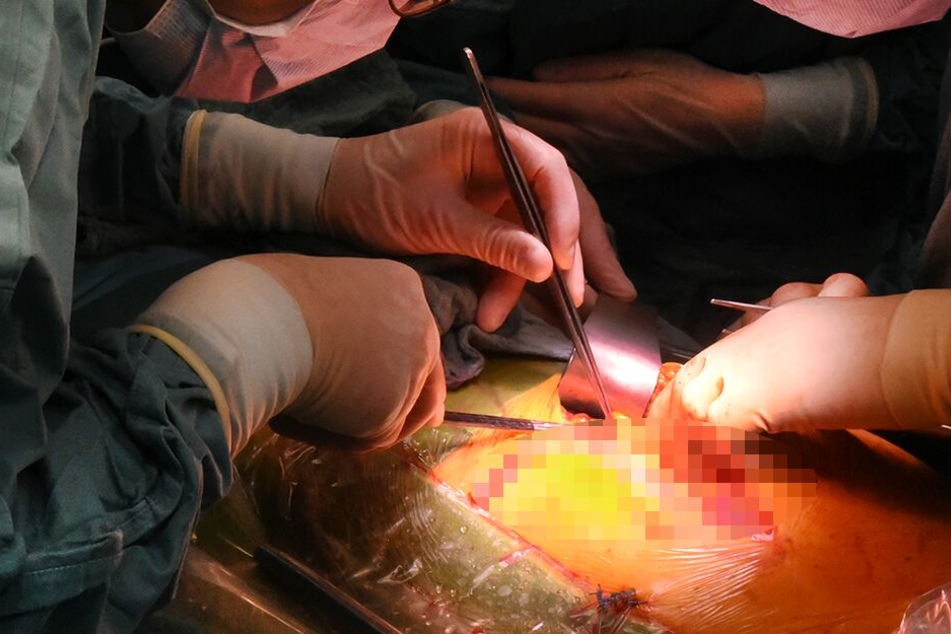 2020 soll eine der Nieren der Krankenschwester transplantiert werden. (Symbolbild)