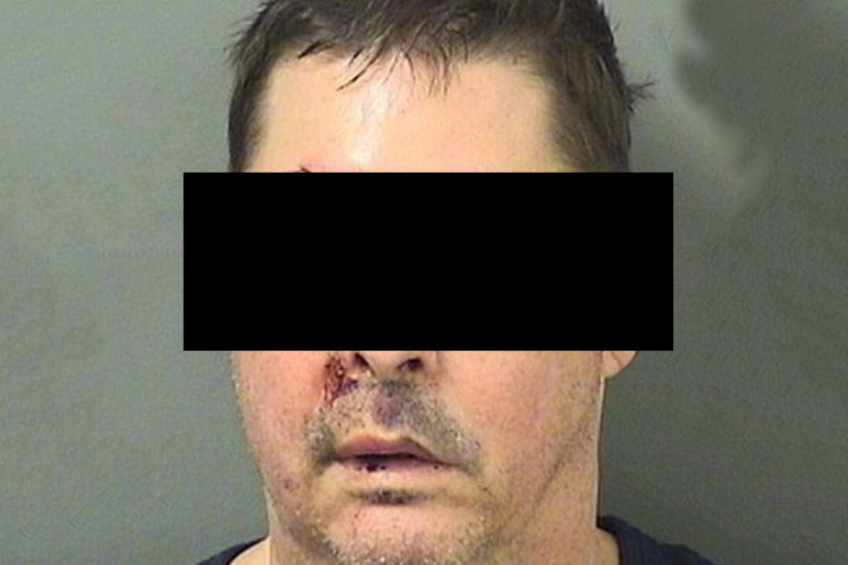 Der Perverse leistete bei seiner Festnahme Widerstand. Das büßte er mit Kratzern, blauen Augen und einer Platzwunde ein.