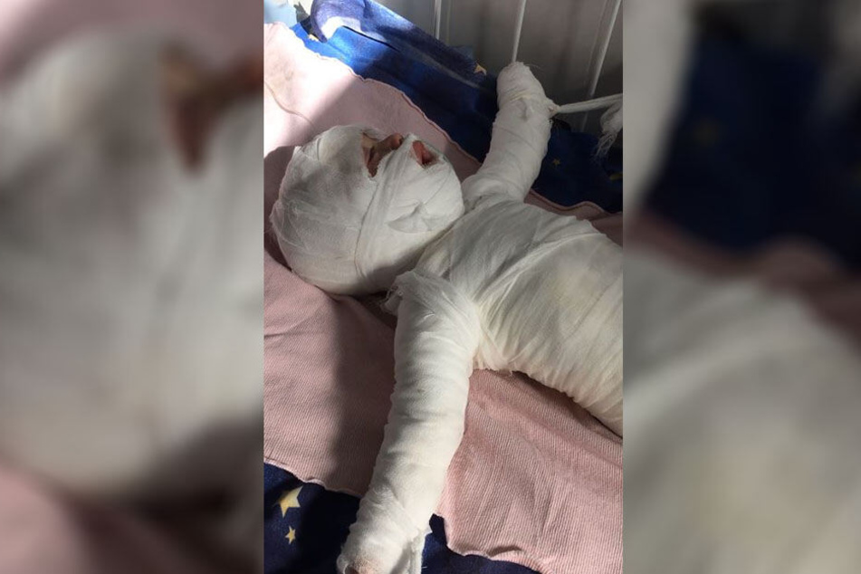 Der Körper des Jungen ist mit Verband eingewickelt.