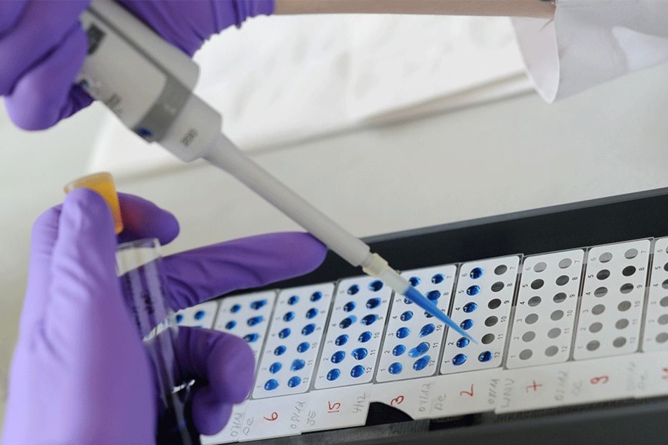 So schlimm wie derzeit soll das Virus in Sri Lanka noch nie gewütet haben (Symbolbild).