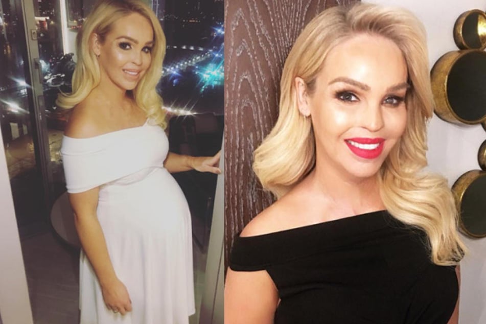 Am 31. März 2008 wurde Katie Piper (33) bei einem Säure-Anschlag völlig entstellt. Heute ist davon kaum noch etwas zu sehen.