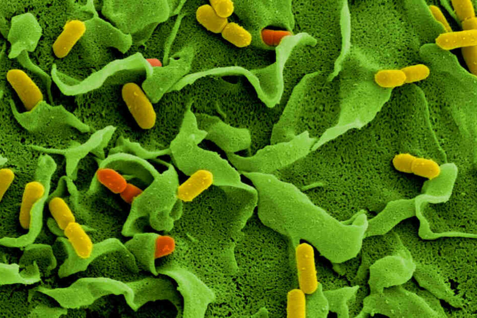 Elektronenmikroskopische Aufnahmen von Listerien (Listeria monocytogenes).