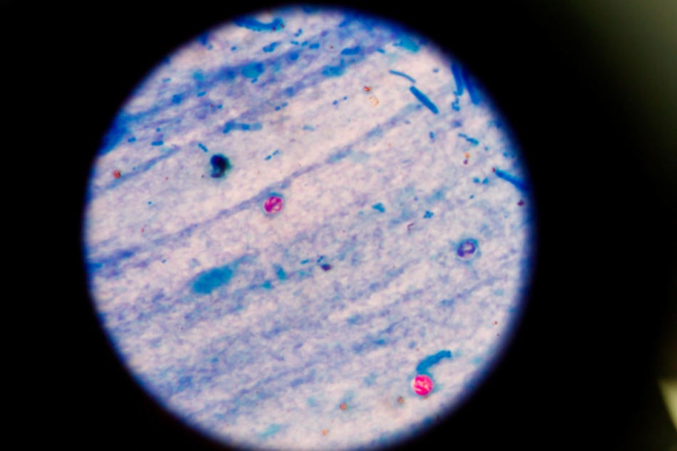 Das Virus Kryptospoidriose unter dem Mikroskop.