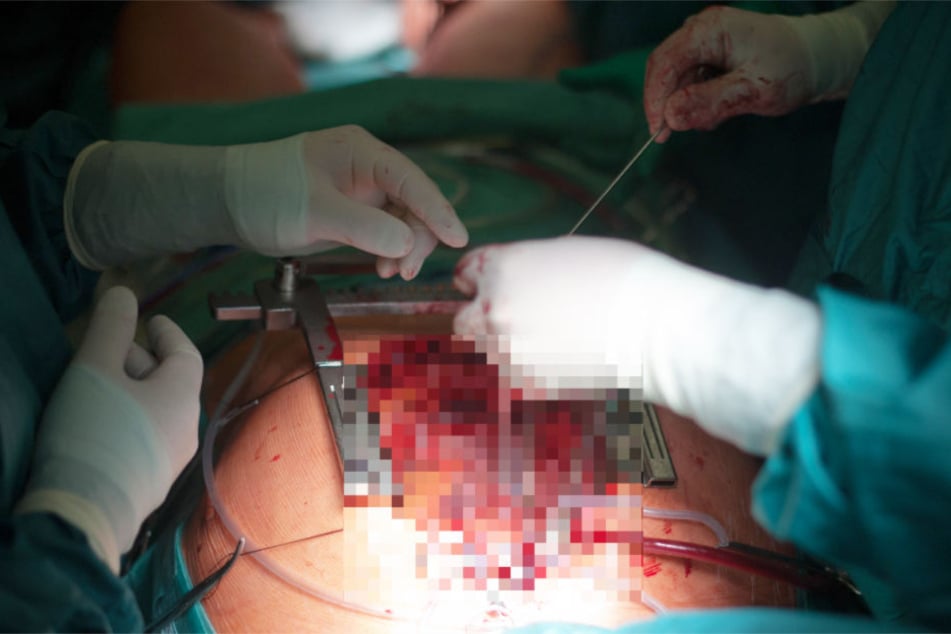 In einem Ulmer Krankenhaus soll bei einer Frau eine Nadel gefunden worden sein.