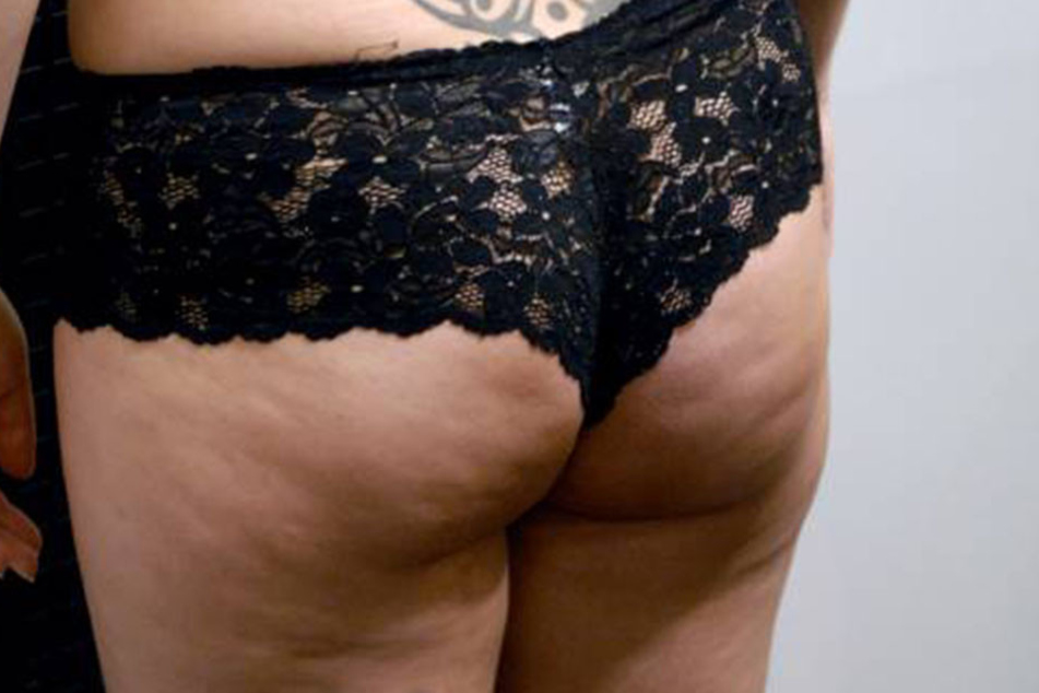 Mittel gegen Cellulite gibt es Tausende, doch wirklich helfen tut keines so richtig. Nun wollen Frauen auf der ganzen Welt zeigen, dass man die Dellen nicht immer verstecken muss.