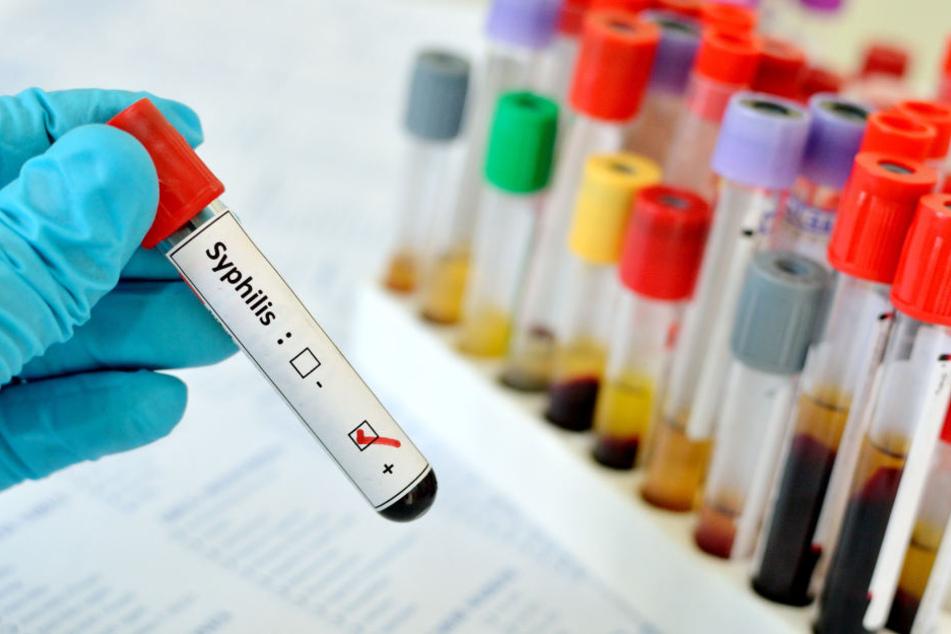 Syphilis, Tripper, Chlamydien – das sind Krankheiten, über die niemand spricht. Genau deswegen infizieren sich immer häufiger Menschen. (Symbolbild)