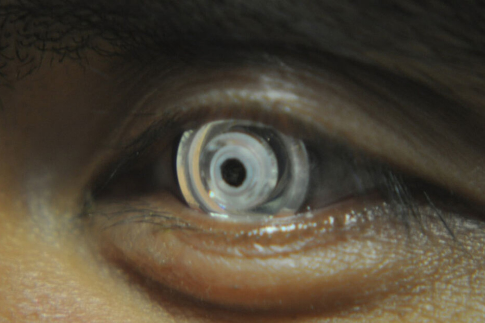 Die Hightech-Kontaktlinse im Auge. Durch Augenbewegung lässt sie sich steuern.