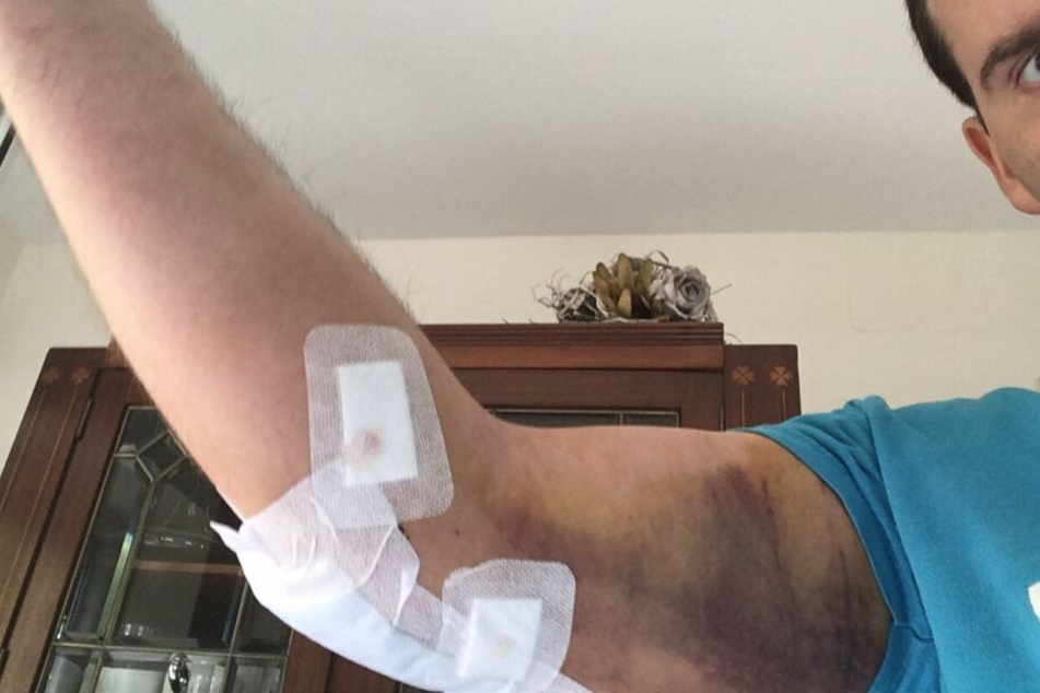 Ali durfte das Krankenhaus mittlerweile wieder verlassen - Schmerzen hat er immer noch.