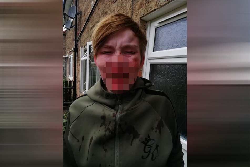 Weil die junge Frau lesbisch ist und das auch offen lebt, wurde sie von ihren "Freunden" als "fucking lesbian" bepöbelt.