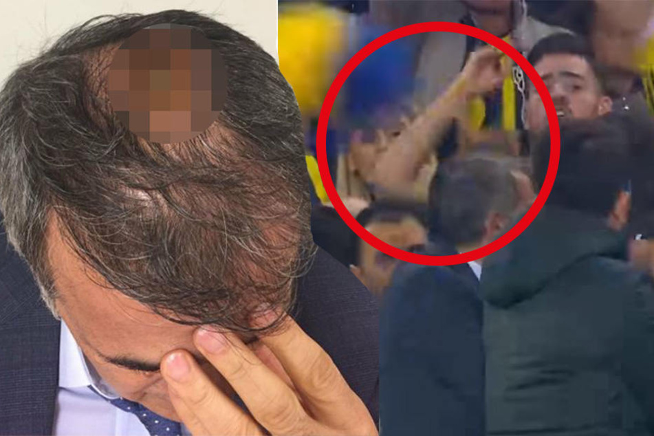 Der Moment, in dem Senol Günes von dem geworfenen Gegenstand getroffen wird.