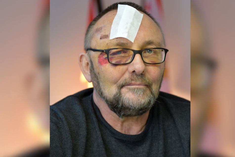 Frank Magnitz wurde am 7. Januar von unbekannten Tätern angegriffen.