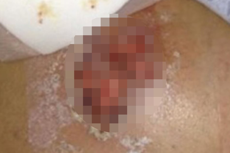 Tagelang hatte Jessica in ihrem eigenen Urin und Kot gelegen, was ihre Haut verätzte.