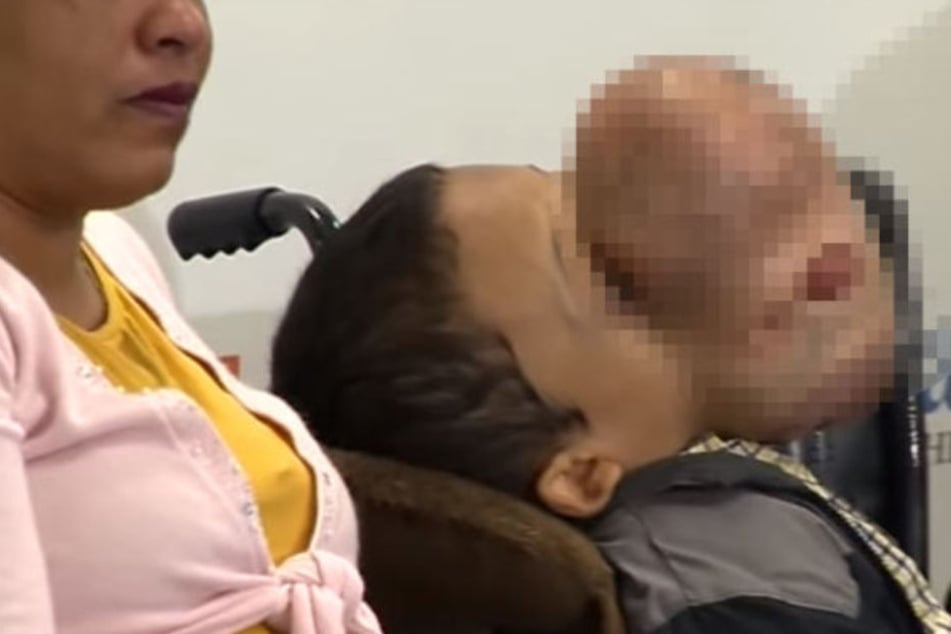 Seit seiner Geburt litt Emanuel Zayas (†14) an einem Tumor, der immer weiter wuchs.