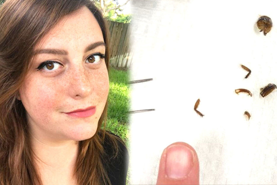 Katie Holley erwachte mit einem Palmetto-Käfer im Gehörgang.