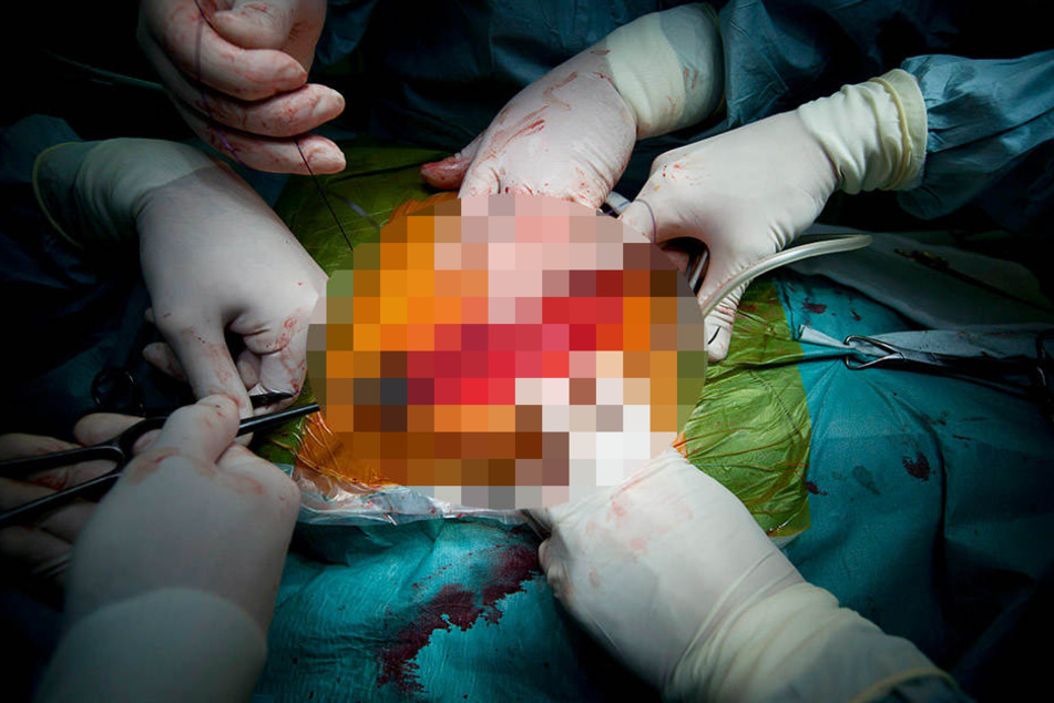 Eine Organtransplantation ist zeit- und somit geldaufwendig. Die Zahl an derartigen Eingriffen geht in Mitteldeutschland stark zurück.