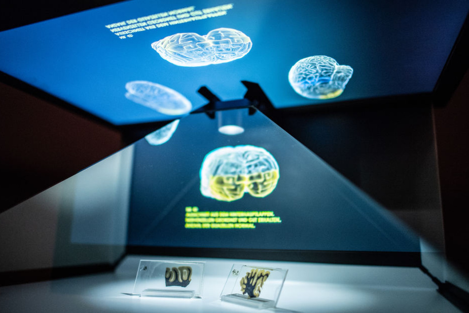 Zwei Scheiben von Albert Einsteins Gehirn werden im Museum präsentiert.