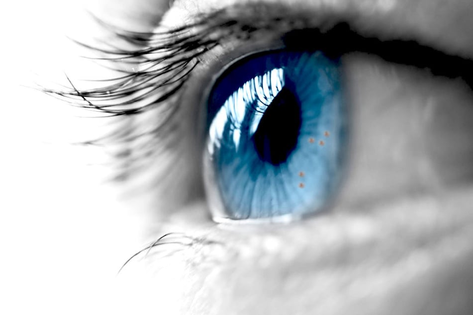 Wie auf der Haut können auch auf der Iris im Auge Melanome entstehen.