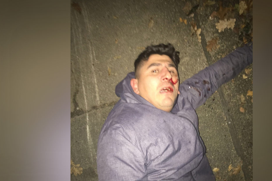 Mit diesem ungewöhnlichen Fahndungsfoto sucht die Polizei Hannover nach einem Räuber.