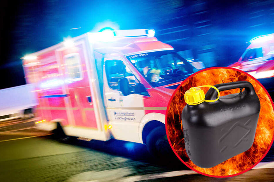 Mit schweren Brandverletzungen musste ein Junge am Sonntag ins Krankenhaus geflogen werden.