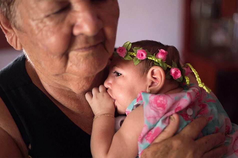 Zahlreiche Babys waren von der lebensgefährlichen Schädelfehlbildung, die durch die Zika-Infektion ausgelöst wurde, betroffen.